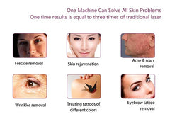 Diode Laser and Picosecond Laser 2 in 1 808 Diode Laser Hair Removal Tattoo Removal Machine with 4 Wavelength 755 808 940 1064nm